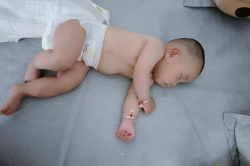 广东宝宝褶皱处擦粉还是油